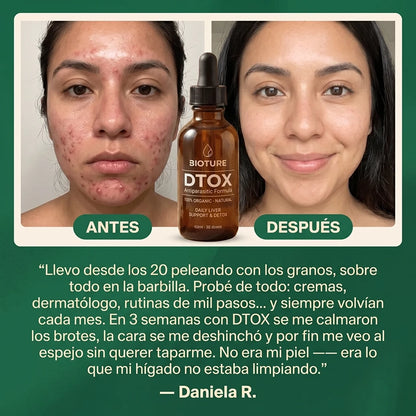 DTOX™ — Formula Natural de Limpieza Profunda de Hígado para la Piel
